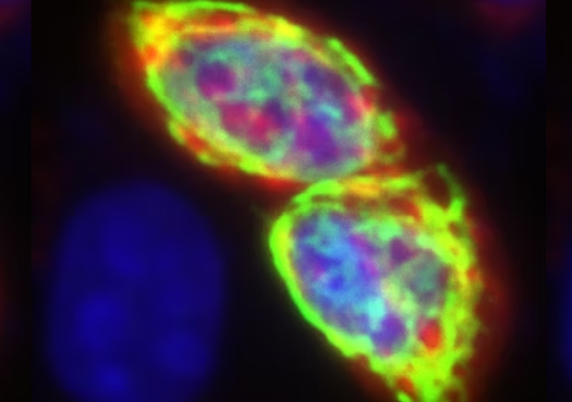 Alzheimer's Research - Neuronal fluorescent microscopy