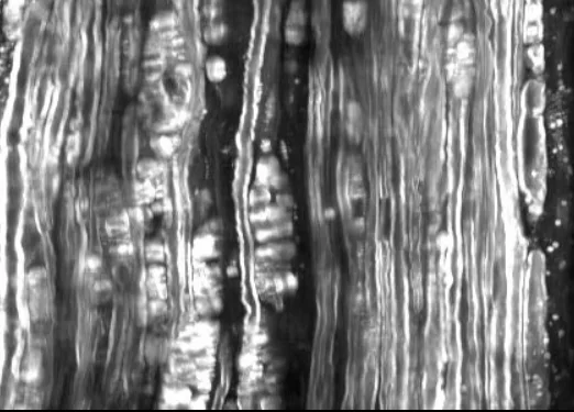 Microscopic neural tissue - ALS research