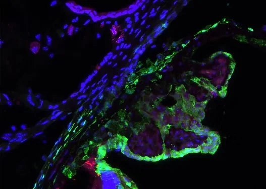 Fluorescent microscopy of retinal tissue - Glaucoma research